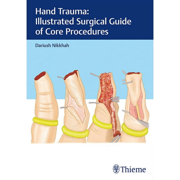 Hand Trauma: Illustrated Surgical Guide of Core Procedures, (Hardcover)