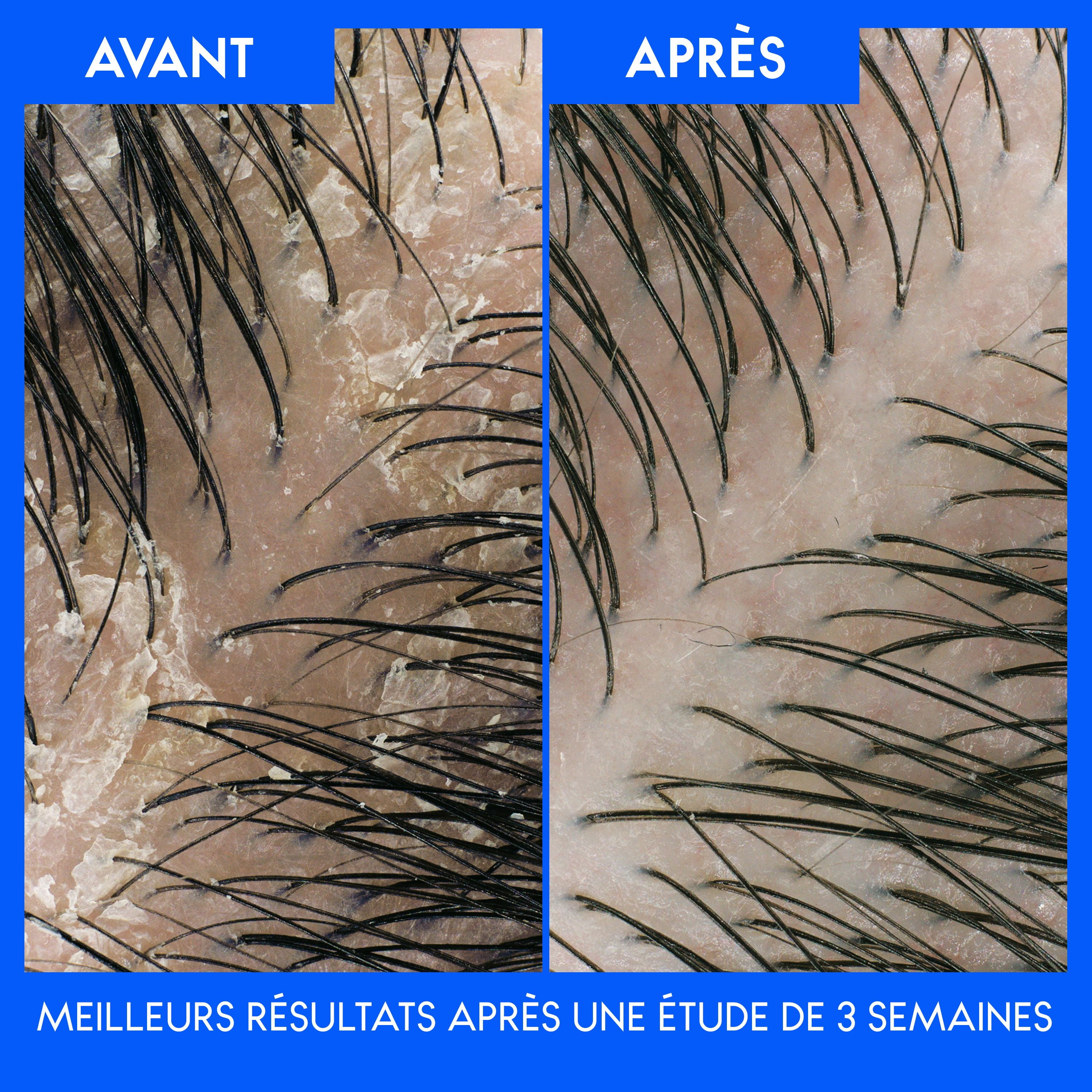 Revitalisant antipelliculaire Head & Shoulders Pomme verte 325ML