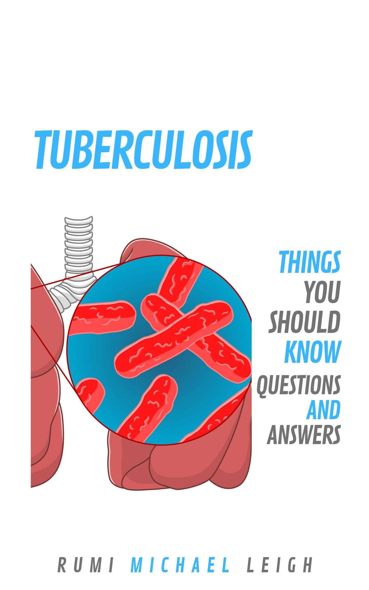 Tuberculosis eBook