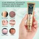 thumbnail image 3 of Scar and scar mark removal ointment cream, 3 of 5