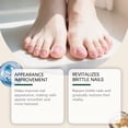 thumbnail image 3 of El suero para el cuidado de las uñas Essence mejora la apariencia, rejuvenece las uñas quebradizas, reduce la decoloración, engrosa y cuida las zonas dañadas. 30 ml de agua esencial., 3 of 8