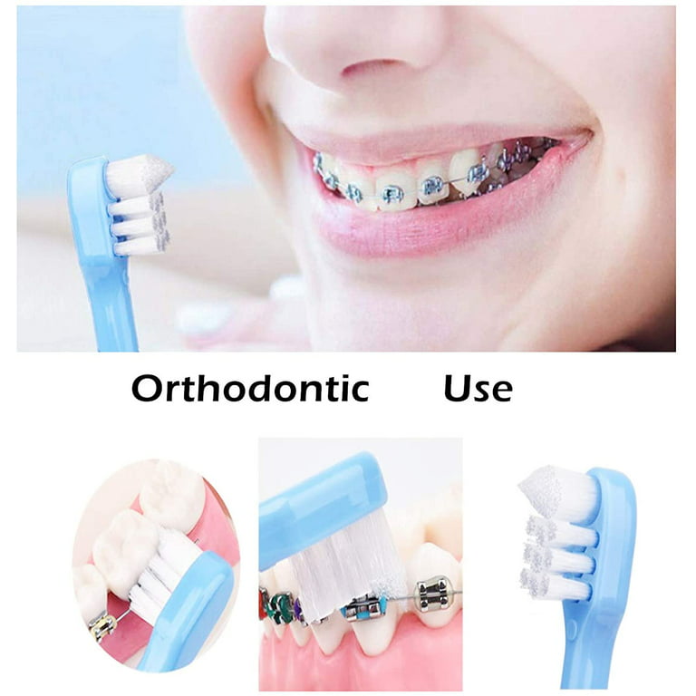 12 Pieces Orthodontic Toothbrush Braces Toothbrush Double-Ended Interdental  Brush V Trim End Toothbrush for Braces Teeth Detail Cleaning White  Toothbrush Head with Protective Covers 4 Colors