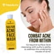 thumbnail image 3 of Limpiador facial TreeActiv Sulfur Acne Original 240 ml para hombres y mujeres, 3 of 7