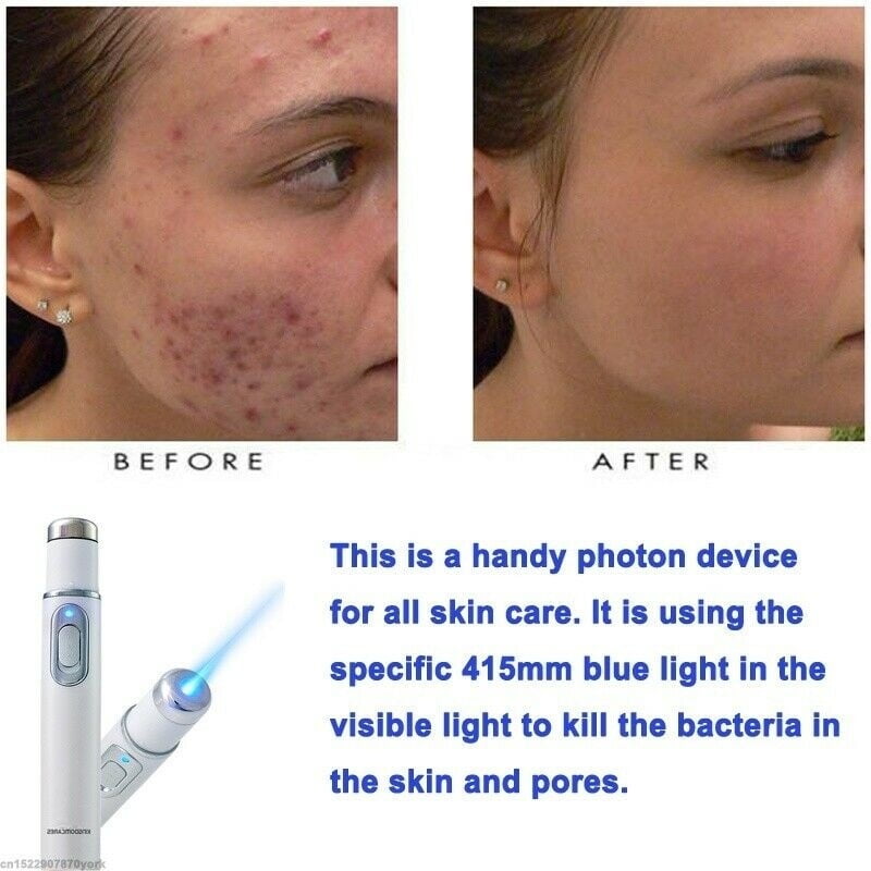 paula's choice fade acne scars