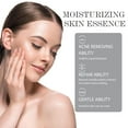 thumbnail image 5 of Gzwccvsn Clear Face And Acne-relieving Cream, Fade Acne Marks, Water And Oil, Acne-removing Cream, 5 of 7