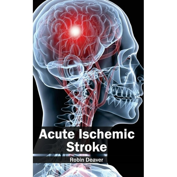 Acute Ischemic Stroke, (Hardcover)