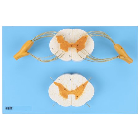 Axis Scientific Enlarged Spinal Cord Model  8X Life Size Nerves Plus Anterior and Posterior Nerve Roots and Spinal Ganglion - Includes Product Manual  and Base for Display price history on PriceWatchPro