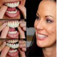 thumbnail image 5 of A Pair Upper Lower High Quality Denture Instant Smile Comfort Fit Flex Cosmetic Teeth Denture Teeth Top Cosmetic Veneer High Quality, 5 of 5