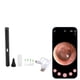 thumbnail image 3 of Kit de herramientas para eliminar cerumen, limpiador de oídos, otoscopio 1080P inalámbrico, otoscopio con 6 luces LED, Kit de limpieza de oídos para adultos y niños, 3 of 8
