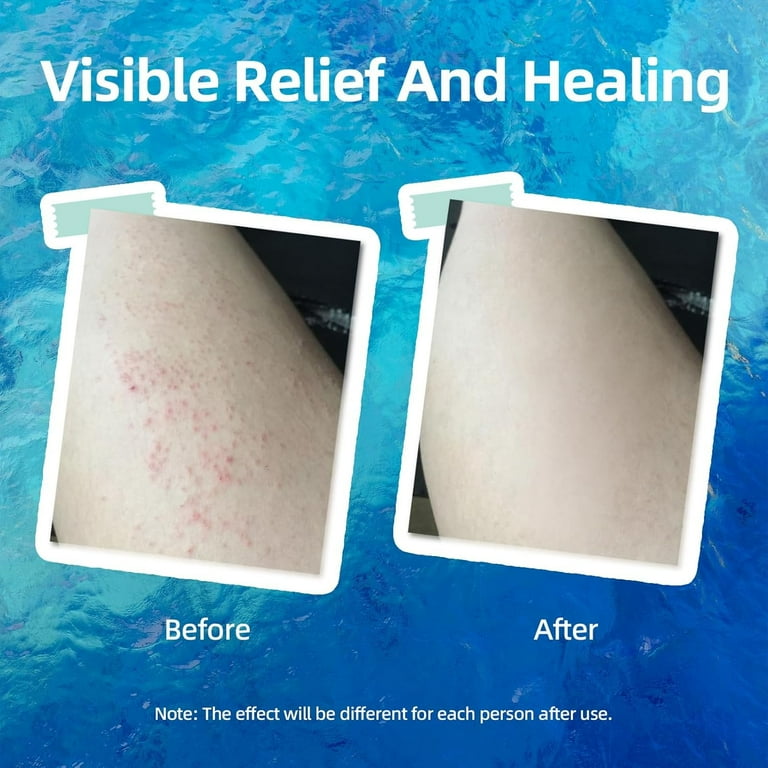 All Natural Eczema Soothing Cream Made with sea moss! Sensitive Skin Dry Skin Hydrating Comfort Moisture Fragrance Free Skin care