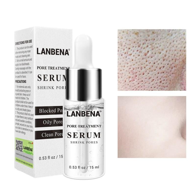 Altsales Pores Treatment Serum Shrink Pore Acne Speckle Acne Stains Hyaluronic Acid Vitamin C Face Essence Skin Care 15ml