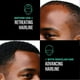 thumbnail image 4 of Unrefined Batana Oil for Hair Growth, Organic Pure Batana Oil, Hair Growth Oil Also Helps with Frizz, Split Ends, Texture & Shine, 4 of 5