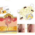 thumbnail image 3 of 2025 1pcs Tag Recede Bee Venom, Tag Recede Bee Venom Treatment Spray Tag Recede Bee Venom, 3 of 5