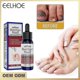 thumbnail image 1 of Nail Treatment Nail Care Manicure And Pedicure Nourishing And Cleansing Removal Of Grey Nails 50ml Box, 1 of 4