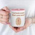 thumbnail image 3 of CafePress - I Had Brain Surgery. What's Mug - 11 oz Ceramic Mug - Novelty Coffee Tea Cup, 3 of 3