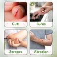 thumbnail image 5 of Tender Gentle Saline Wound Wash Spray, 8 oz - Wound Spray for Cleaning, Adjustable Nozzle - Good for Sensitive Skin - 6 Pack, 5 of 7
