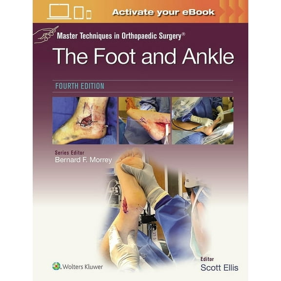Master Techniques in Orthopaedic Surgery Master Techniques in Orthopaedic Surgery: The Foot and Ankle: Print   eBook with Multimedia, (Hardcover)