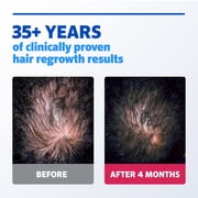 Mens Rogaine Extra Strength 5% Minoxidil Topical Solution, 1-Month
