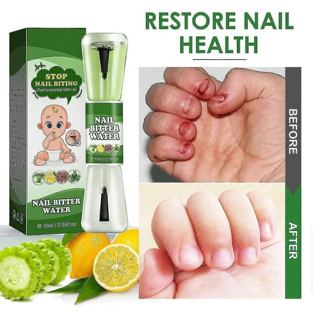 Nail Biting Treatment For Kids, 10ml Anti Bite Nail Polish With Bitter Taste, Nail Stick Effectively Stop Biting Nails And Thumb Sucking