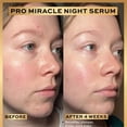 thumbnail image 3 of Revolution Pro, Sérum Miracle Night Rescue Complexe Avancé, Sérum de Nuit pour le Visage, Lisse & Peau, 1.01 fl.oz, 3 of 7