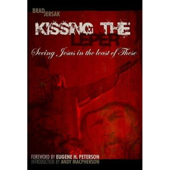 Pre-Owned Kissing the Leper: Seeing Jesus in the Least of These (Paperback) 0978017404 9780978017408