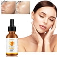 thumbnail image 1 of Hot6sl Ofertas de La Semana Vitamina C, Vitamina C, 100 Ml, 20 Ml, 1 of 7