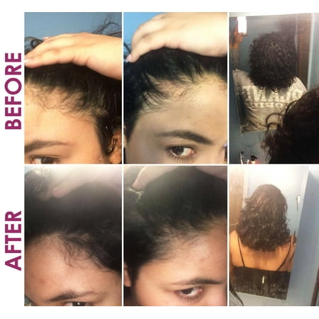 Buy Hair Loss & Regrowth Treatment Hair Care Lotion Drops for Men & Women with Ginger & Royal Jelly by Sorrel Cosmetics | Sulfate & Paraben Free Growth Stimulating Dropper 4 oz | Buy Hair Loss & Regrowth Treatment Hair Care Lotion Drops for Men & Women with Ginger & Royal Jelly by Sorrel Cosmetics | Sulfate & Paraben Free Growth Stimulating Dropper 4 oz |
