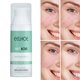 thumbnail image 3 of Crema antiacné, , tratamiento suave para el acné, reducción de , eliminación de espinillas, atención facial, blanqueamiento, inflamación, Yinane Eliminación, 3 of 8