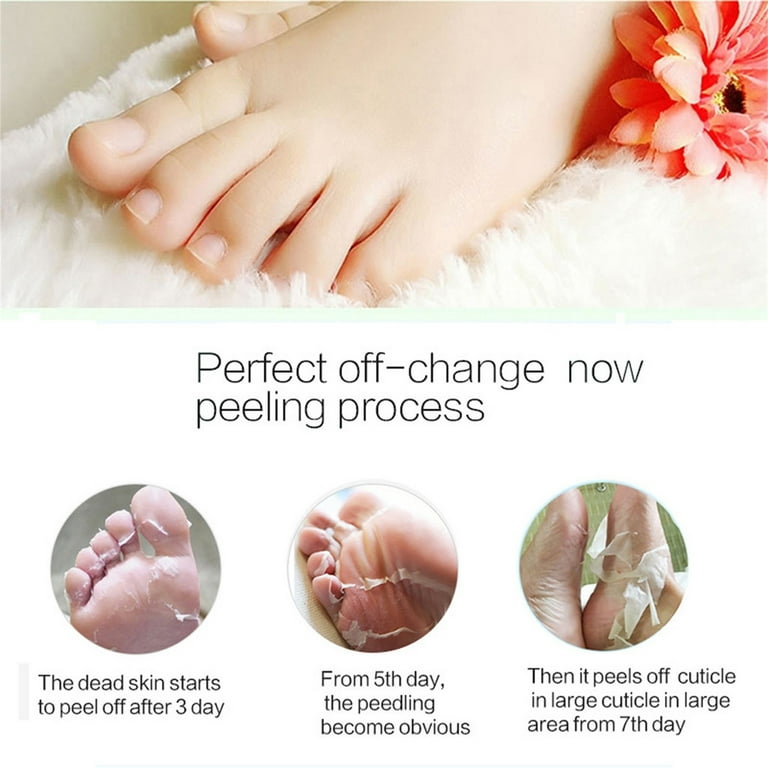 Peeling dead skin off feet deals
