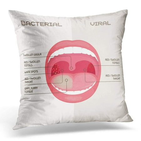 CMFUN Bacteria Anatomy of Throat Bacterial and Viral Infection Tonsils Inflammation Angina Disease Pillow Case Cushion Cover 20x20