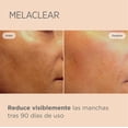 thumbnail image 4 of MELACLEAR SERUM (VITAMINA C/ACIDO FITICO) Isdin FRASCO CON 15 ML, 4 of 6