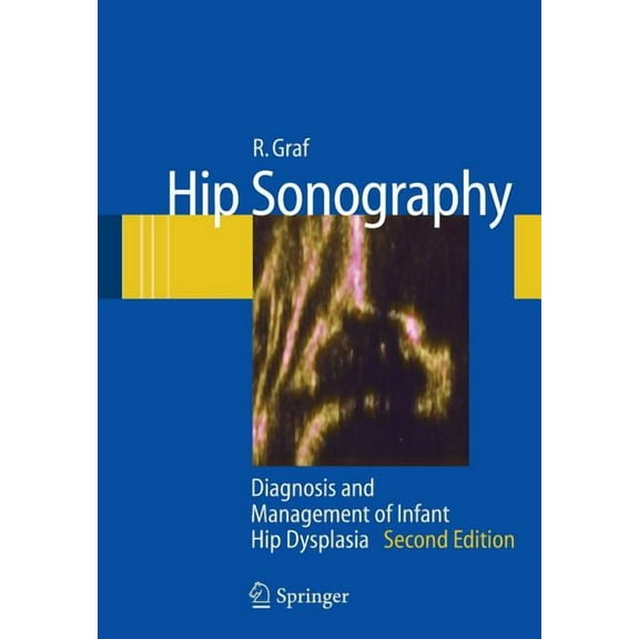 Hip Sonography: Diagnosis and Management of Infant Hip Dysplasia, (Paperback)