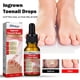 thumbnail image 1 of Suavizante de uñas encarnadas Suero Corrección de uñas Recuperar Aceite Analgésico Ndcxsfigh  Nuevos Originales, 1 of 9