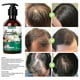 thumbnail image 3 of Jaysuing Garlic Shampoo, Itchy Hair Anti-Dandruff Shampoo For Nourishing Hair Shampoo For Preventing Hai, 3 of 5