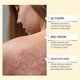 thumbnail image 5 of Bee Venom Comprehensive Cream, Anti-wart Reduces Blemishes, 2025 New Bee Venom Skincare Treatment Cream For All Skin Types, 5 of 5