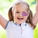thumbnail image 4 of 20 parches oculares prácticos para corregir la ambliopía, para niños, gafas transpirables y máscaras para estrabismo., 4 of 7