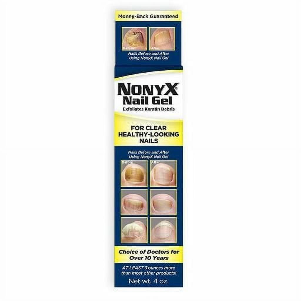 NONYX Fungal Nail Clarifying Gel, Clears Out Keratin Debris Where Nail  Fungus Thrives, 4 oz. : Amazon.sg: Beauty
