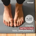 thumbnail image 3 of Kerasal Nail Fungus Extra Strength | Restorative Nail Repair for Damaged Nails, 0.33 fl oz, 3 of 14
