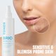 thumbnail image 3 of Skin Toner Briotech Skin Renew con ácido hipocloroso 120 ml, 3 of 8