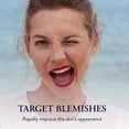 thumbnail image 4 of Gel Phytomer OLIGOPUR Blemish Target, 30 ml, antimanchas, 4 of 5