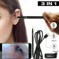 thumbnail image 2 of AMERTEER 1.5M Led Otoscope Ear Camera Scope Earwax Removal Kit Ear Wax Cleaning Tool, 2 of 11