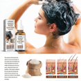 thumbnail image 4 of Jaysuing Fermented Rice Water Hair Essence Gentle Moisturizing Growth Hair Repair Hair Dry Hot Dyeing Damaged Essential Oil - 10Ml Boxed, 4 of 5