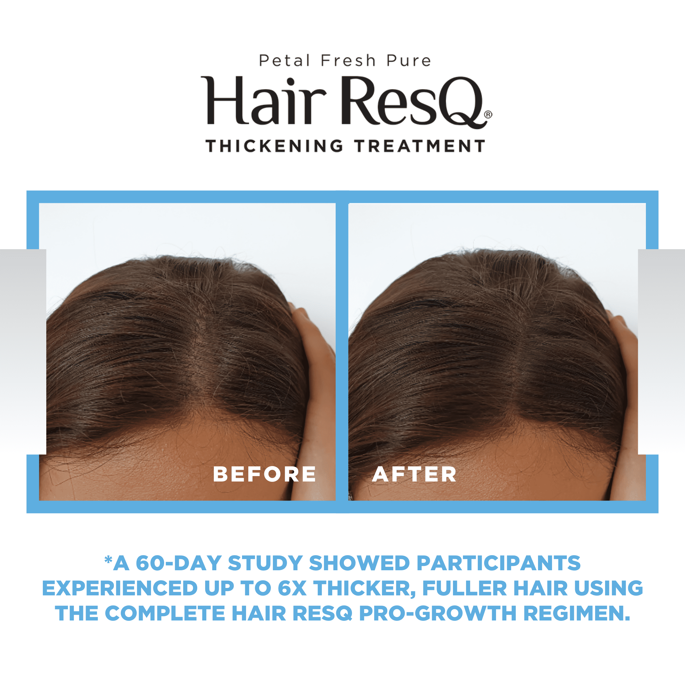 Petal Fresh Hair ResQ Thickening Shampoo, Advanced Biotin Pro-Growth Formula for All Hair Types, 12 fl oz