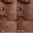 thumbnail image 2 of Sérum Clinique Even Better Clinical Dark Spot, 50 ml, con vitamina C, 2 of 9