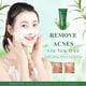 thumbnail image 1 of Clearance, Natural Facial Cleansing Foam Oil Control Acne Cleanser, 1 of 4