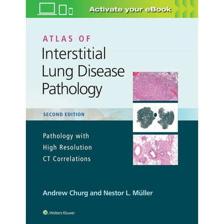 UPC: 9781975124670 | Atlas of Interstitial Lung Disease Pathology (Hardcover)