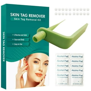 Buy Skin Tag Remover - Skin Tag and Mole Removal Kit for Home Use, Portable Skin  Tag Remover Pen for Mole, Wart and Skin Tag for Women and Girls OPHERA  Online at