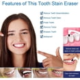thumbnail image 4 of JJEAN-Tooth Stain Remover, Dental Plaque Tool, Tartar Eraser Polisher, Professional Teeth Whitening Polishing Cleaning Kit, Home Calculus Removal Effectively, NOT Electric Cleaner Brush/Dentist, 4 of 4
