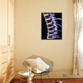 thumbnail image 4 of Spine And Spinal Nerves,computer Artwork, Framed Art Print Wall Art by PASIEKA Sold by Art.Com, 4 of 5