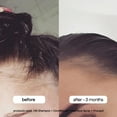 thumbnail image 3 of Bondiboost Intensive Thickening Spray [4.23 Fl Oz] Daily Leave In Hair Treatment To Reduce Hair Loss Lightweight Mist For Thinning Hair + Density For Men & Women Rosemary & Tea Tree Formula, 3 of 4